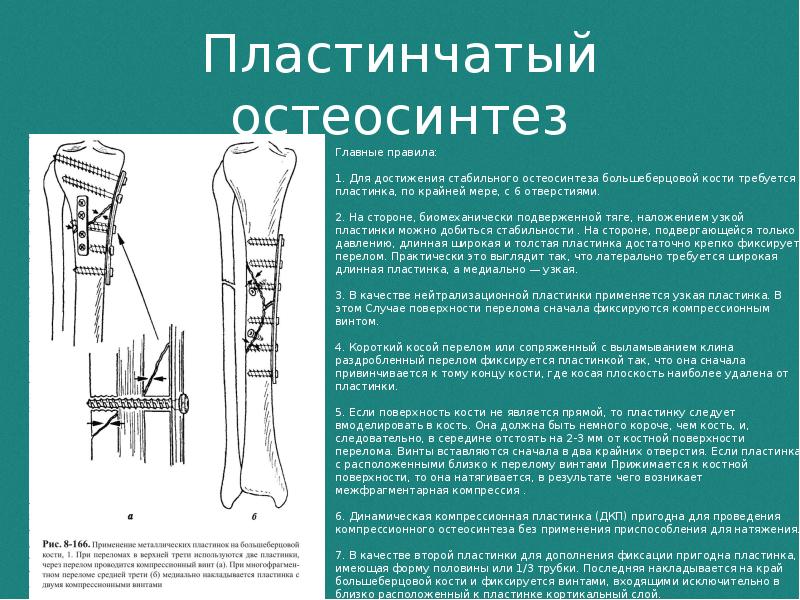 Карта вызова закрытый перелом большеберцовой кости