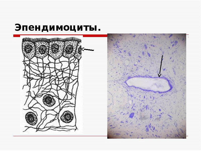 Эпендимная глия гистология препарат. Эпендимоциты: гистогенез, локализация, форма, строение, функции. Эпендимоциты нервной ткани. Эпендимоциты. Функции эпендимы желудочков мозга.