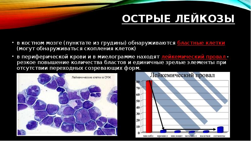 Острый лейкоз презентация