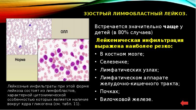 Презентация по лейкозам