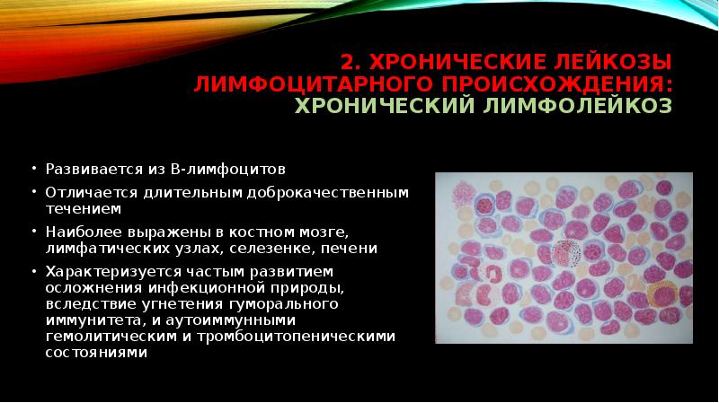 Лейкозы у детей презентация