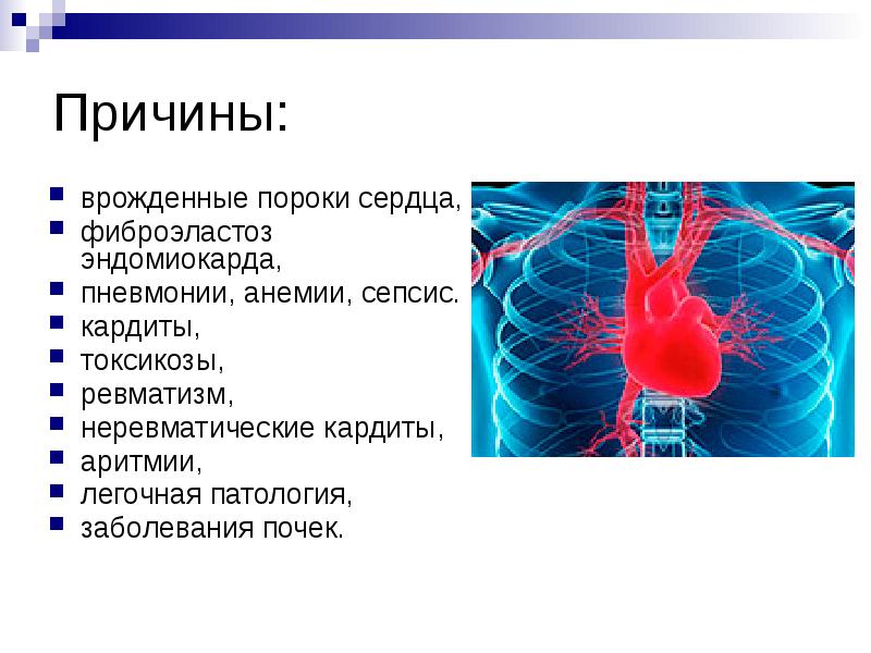 Неревматический кардит у детей презентация