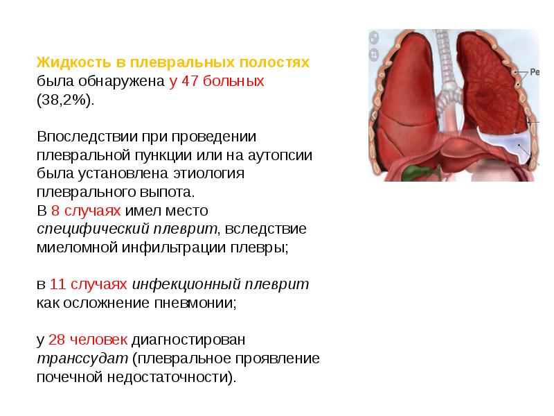 Очаги экстрамедуллярного кроветворения. Синдром экстрамедуллярного поражения. Экстрамедуллярные очаги кроветворения. Экстрамедуллярный инфильтрат.