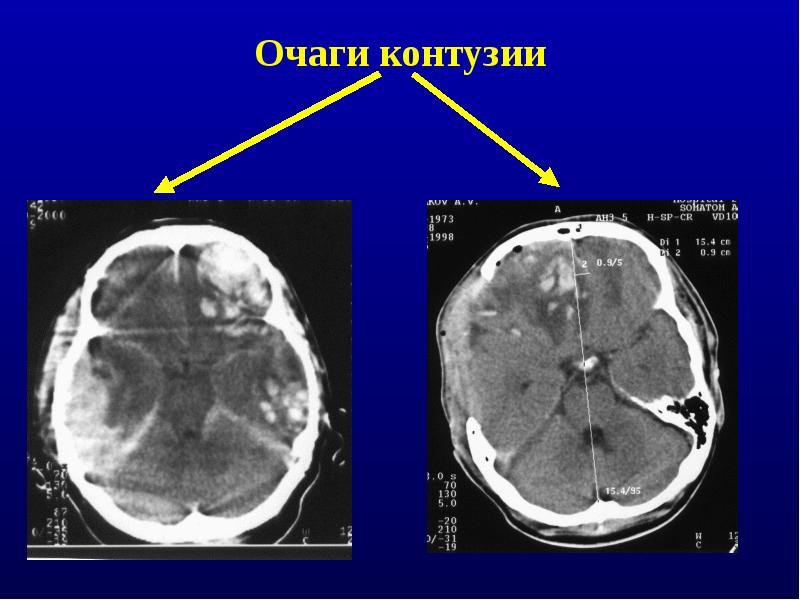 2 орлов ю а руководство по диагностике и лечению черепно мозговой травмы год выпуска 2004