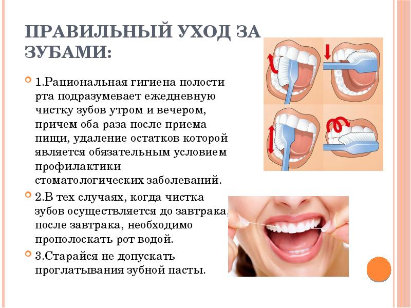 Правильный уход за зубами. Гигиена зубов и полости рта. Правильный уход за зубами и полостью рта. Сильная чувствительность зубов