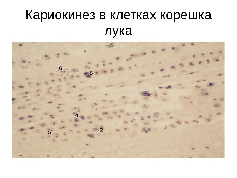 Кариокинез в клетках корешка лука