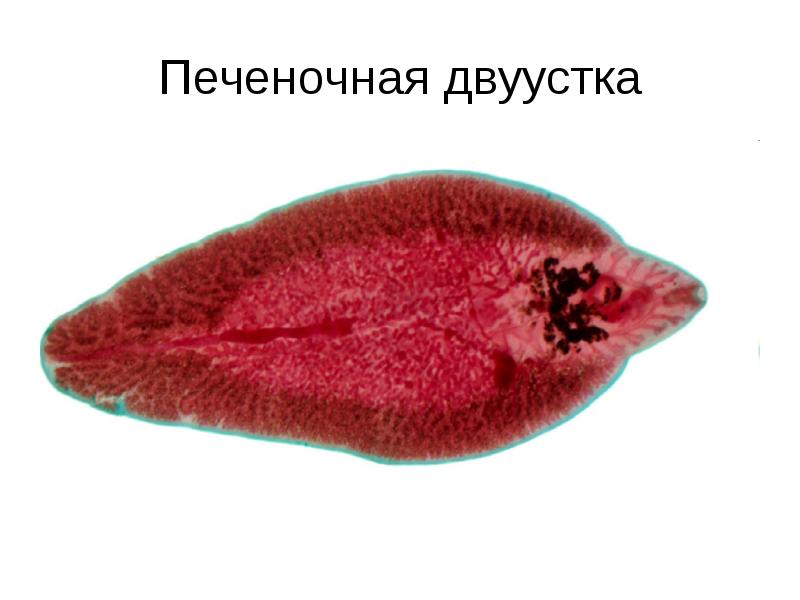 Печеночная двуустка