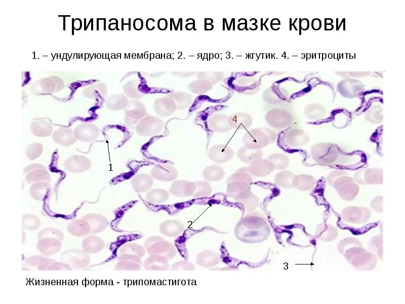 Трипаносома в мазке крови