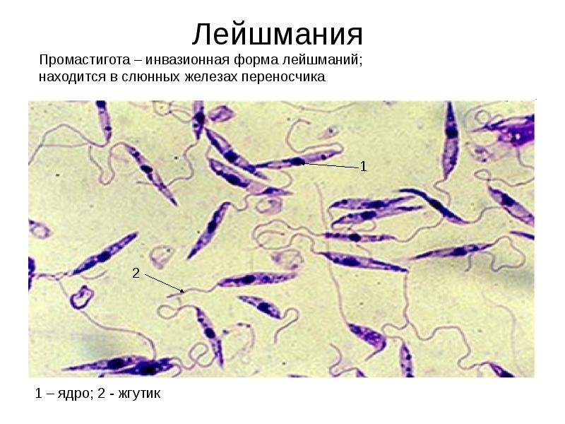 Лейшмания рисунок с подписями