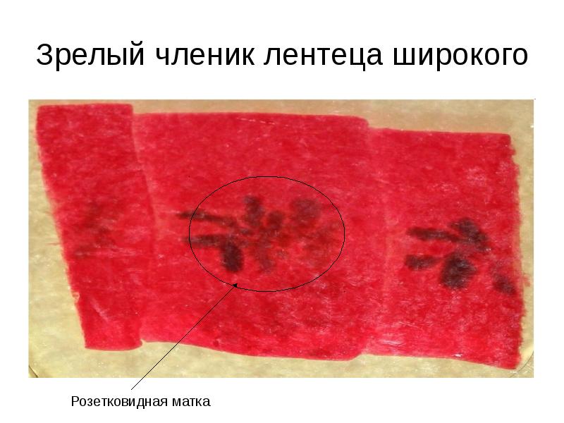 Зрелый членик лентеца широкого