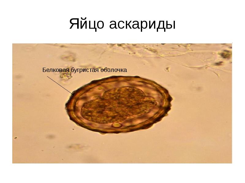 Яйцо аскариды
