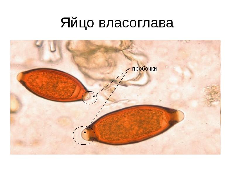 Яйцо власоглава