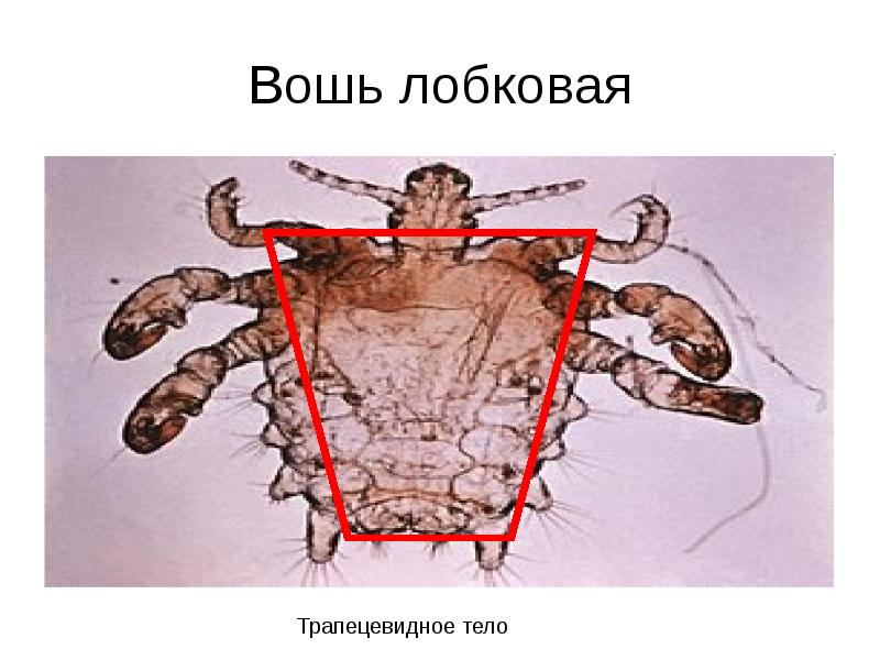 Вошь лобковая