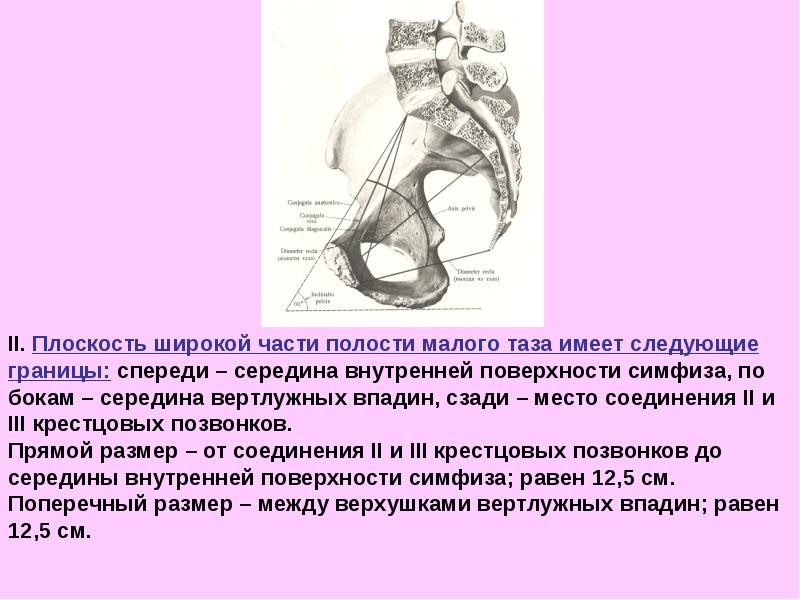 Размеры женского таза презентация