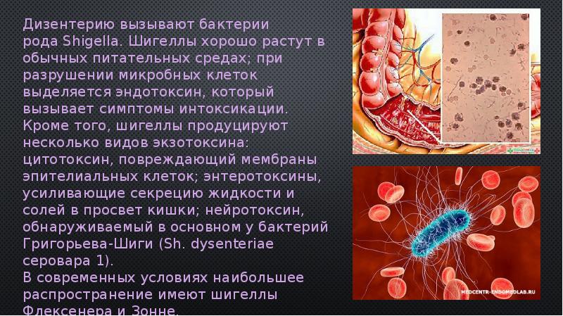 Презентация про дизентерию