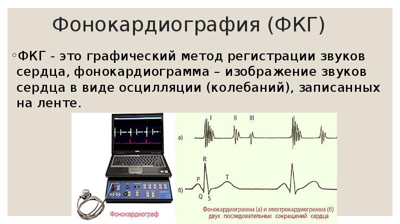Фонокардиография (ФКГ) ФКГ - это графический метод регистрации звуков сердца, фонокардиограмма