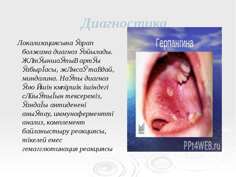 Диагностика
Локализациясына қарап болжама диагноз қойылады. Жұтқыншақтың артқы қабырғасы, жұмсақ Диагностика
Локализациясына қарап болжама диагноз қойылады. Жұтқыншақтың артқы қабырғасы, жұмсақ