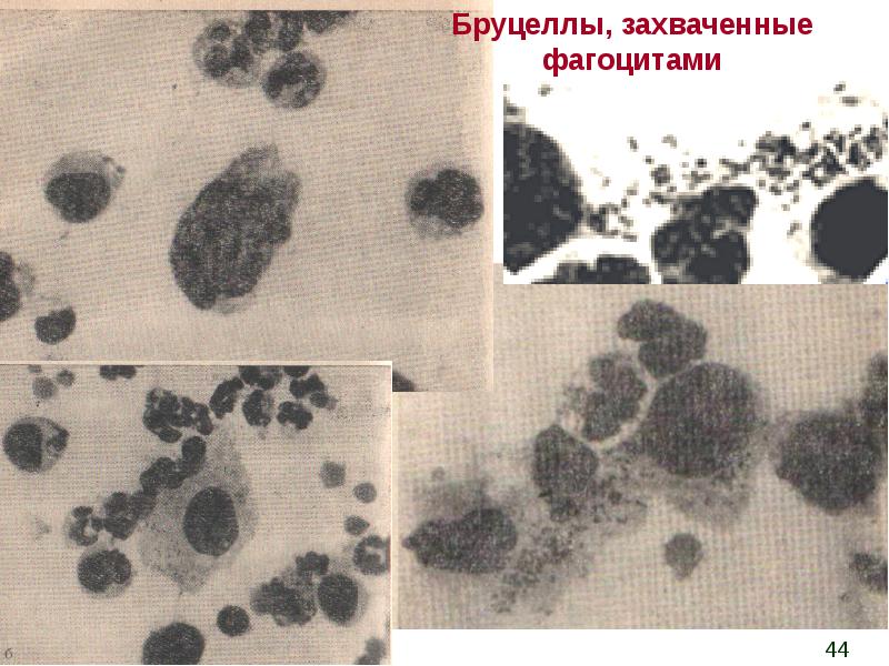 Возбудители бруцеллеза презентация