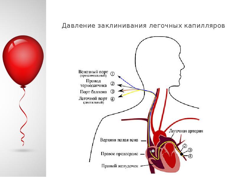 Дегидратационный синдром презентация