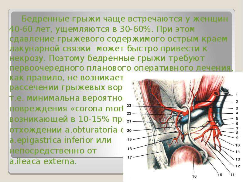 Бедренная грыжа картинки