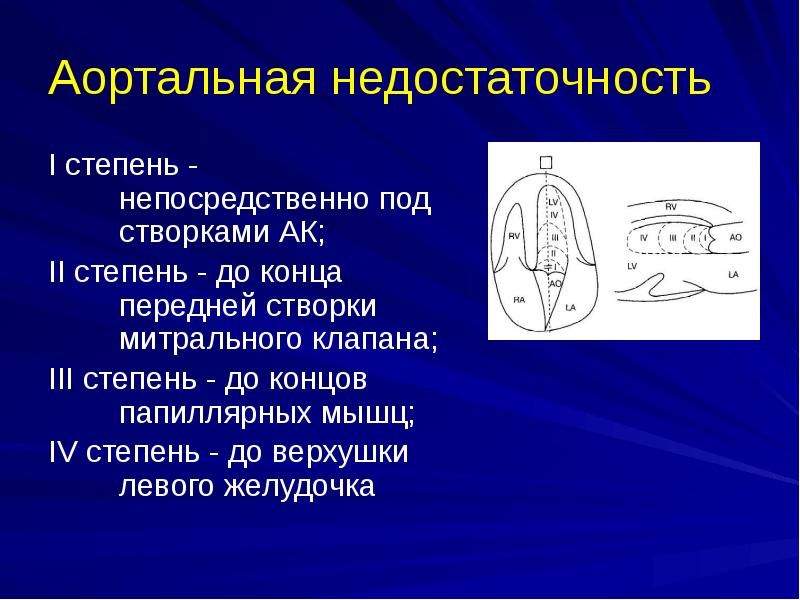 Аортальная недостаточность презентация