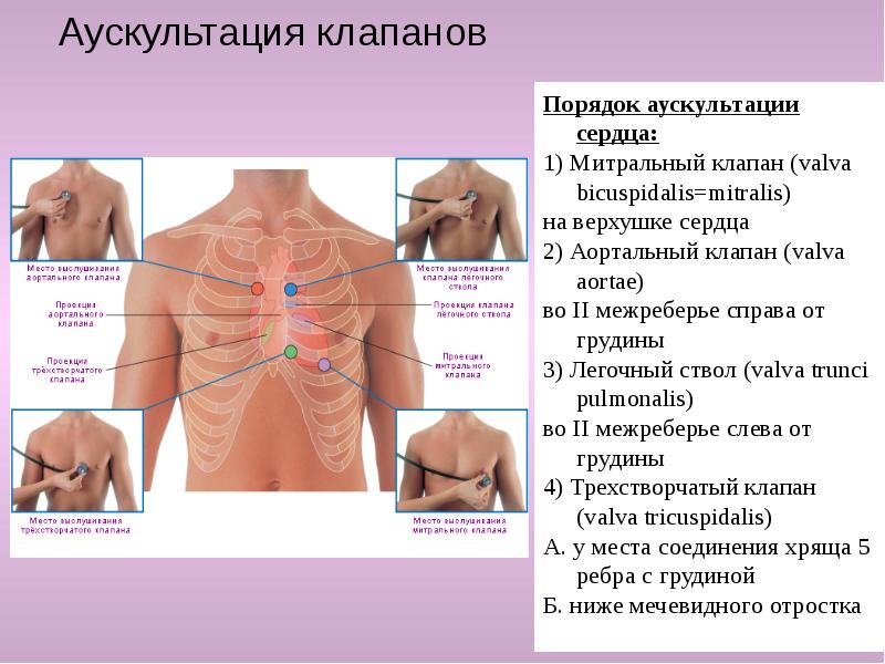 Клапаны сердца схема аускультации