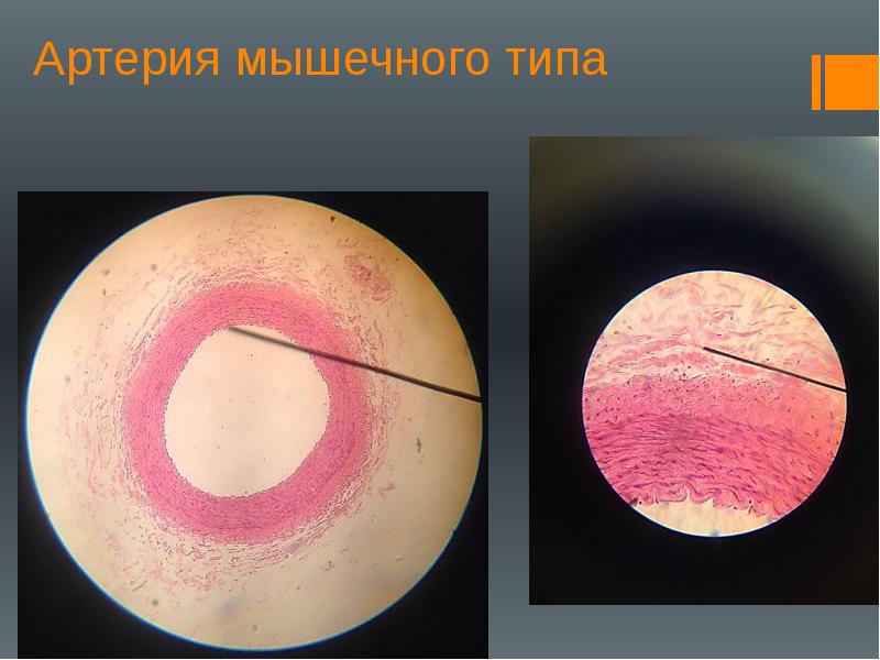 Рисунок артерии мышечного типа