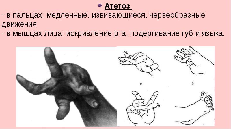 Нервная система пропедевтика презентация