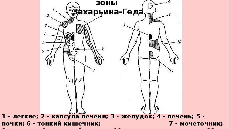 Зоны захарьина геда схема и описание атлас