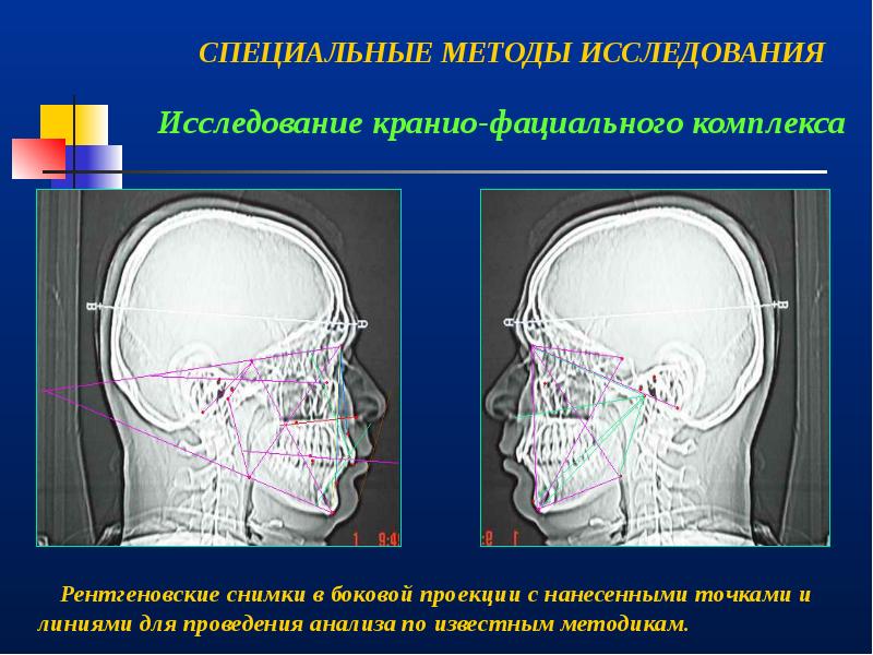 Врожденная патология кранио фациальной области презентация