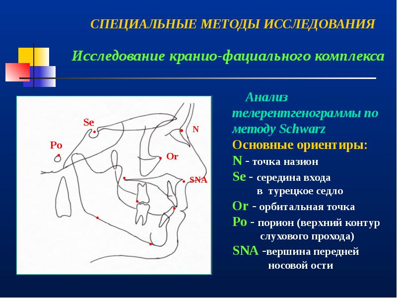 Врожденная патология кранио фациальной области презентация