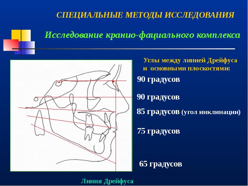 Врожденная патология кранио фациальной области презентация