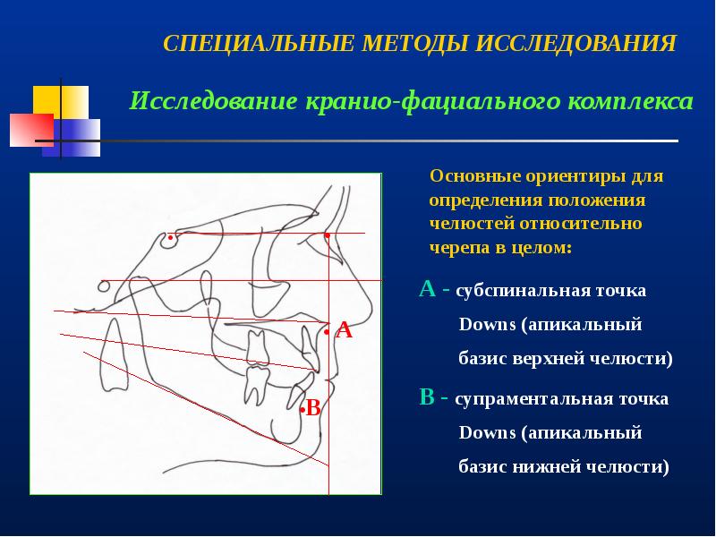 Врожденная патология кранио фациальной области презентация