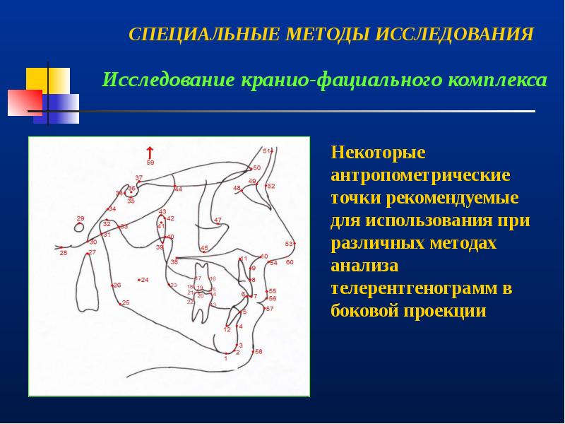 Врожденная патология кранио фациальной области презентация