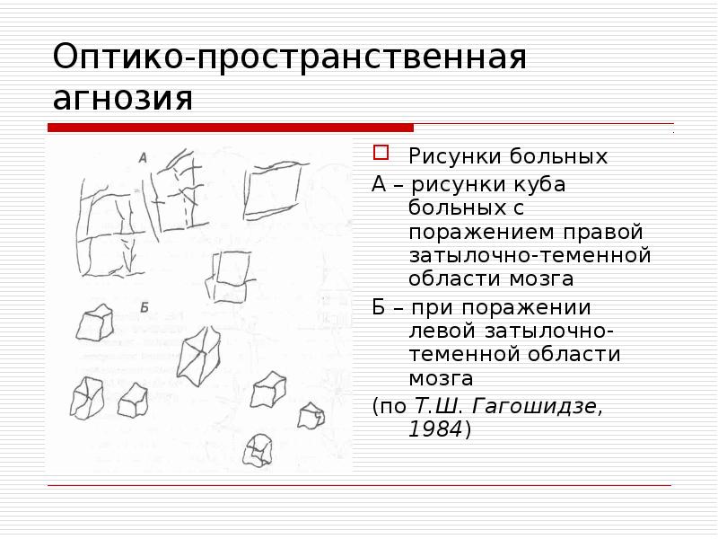 Вид агнозии характеризующийся нарушением узнавания предметов или их изображений