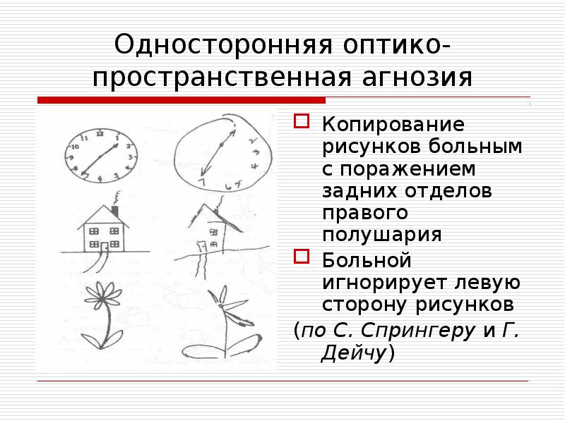 1 схему рисунок отражающие нарушения зрительного внимания игнорировании какой либо стороны