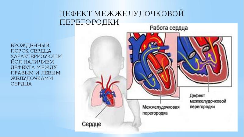 Системы ребенка