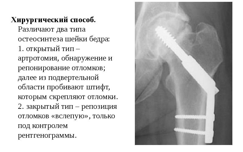 Повреждения нижних конечностей презентация