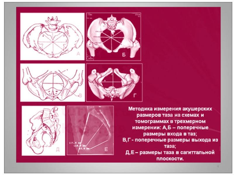 Введение в акушерство и гинекология презентация - 85 фото