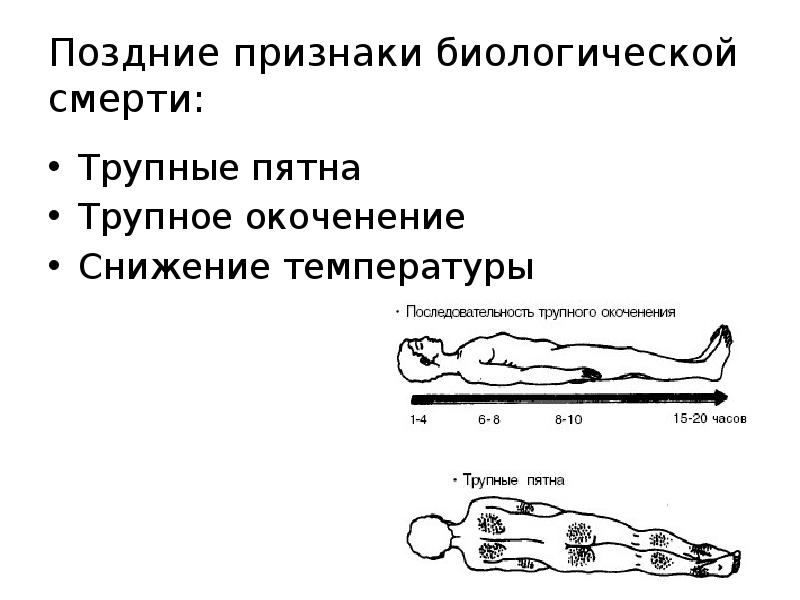 Трупное окоченение презентация