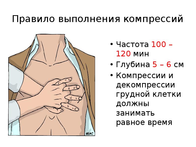 Частота компрессии грудной клетки составляет