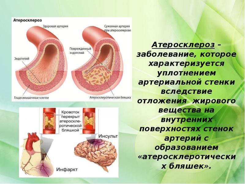 Экскурсия артериальной стенки