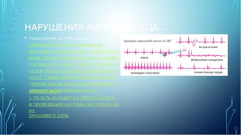 Нарушение сердечного ритма презентация