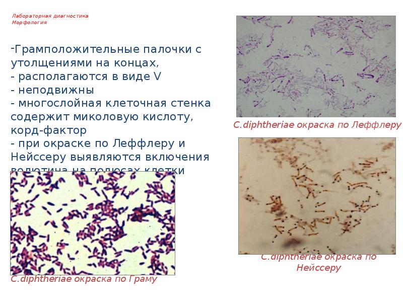 Презентация на тему коклюш микробиология