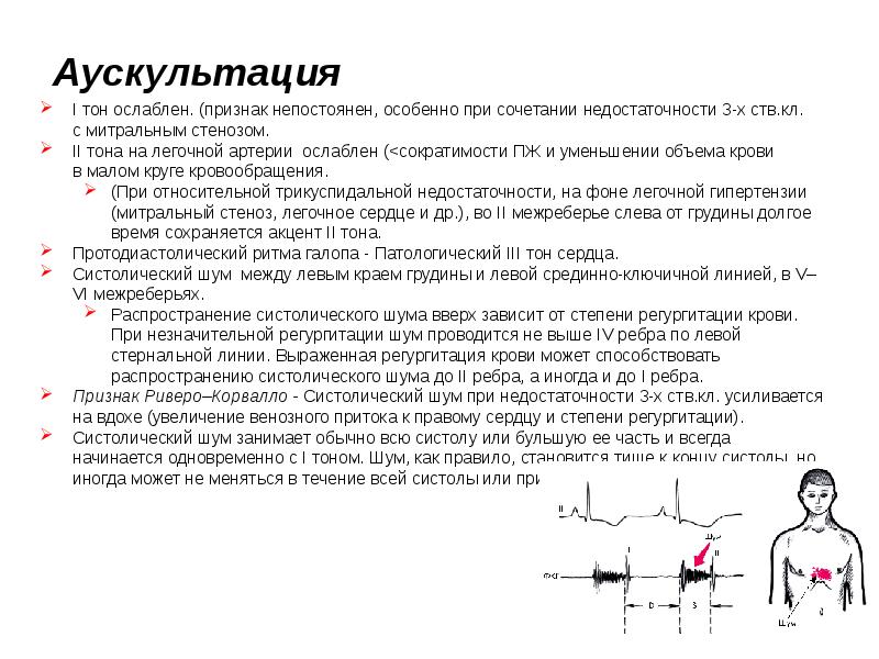 Атрезия трехстворчатого клапана презентация