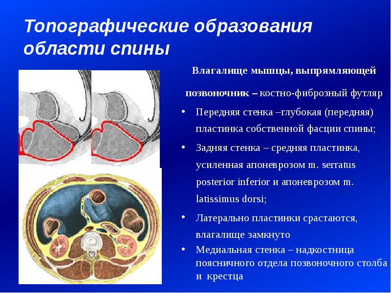 Образование мышц. Влагалище мышцы выпрямляющей позвоночник. Топографические образования спины. Топографические образования туловища. Мышцы фасции и топография спины.