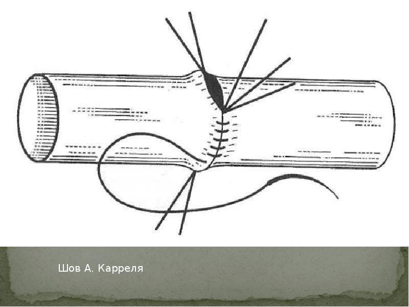 Сосудистый шов топографическая анатомия презентация