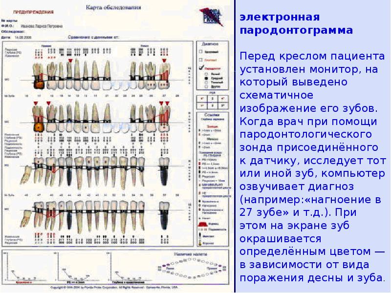 Карта исследования пародонта