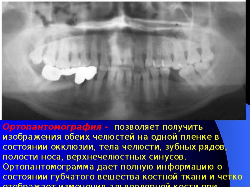 Первичная травматическая окклюзия презентация