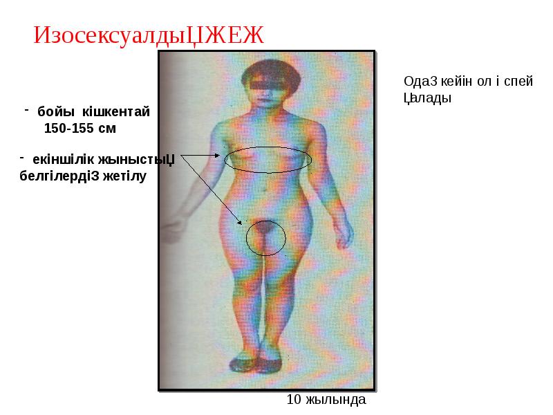 Изосексуалдық ЖЕЖ Изосексуалдық ЖЕЖ